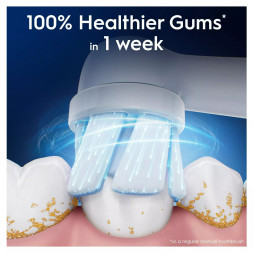 Сменные насадки для зубной щетки Oral-B iO Gentle Care (4 шт.)